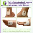 U Shaped Felt Callus Pads - Adhesive Foot Pads That Protect Calluses from Rubbing On Shoes - Skived 1 4  Cheap